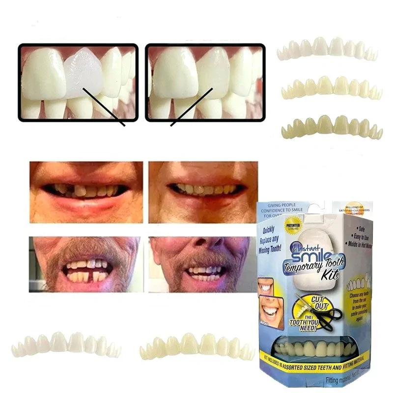 Instant smile - fogsor javító készlet vészhelyzet esetére - ideiglenes fogpótlás készítő