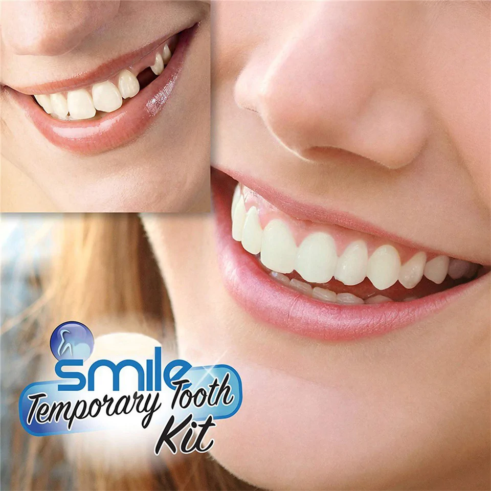 Instant smile - fogsor javító készlet vészhelyzet esetére - ideiglenes fogpótlás készítő