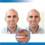 Instant smile - fogsor javító készlet vészhelyzet esetére - ideiglenes fogpótlás készítő